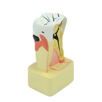 G5AA Zubné Zuby Model Periodontal Analýza Komunikácia medzi pacientom a Lekárom